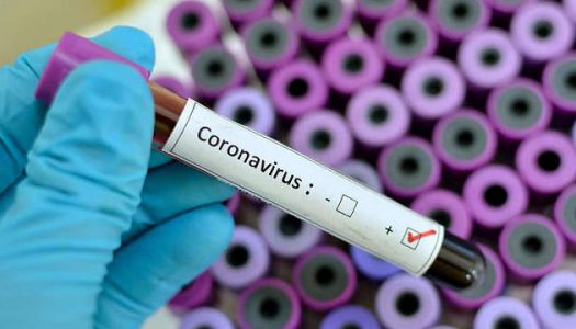 Coronavírus: como diminuir a chance de contágio em voos e aeroportos.